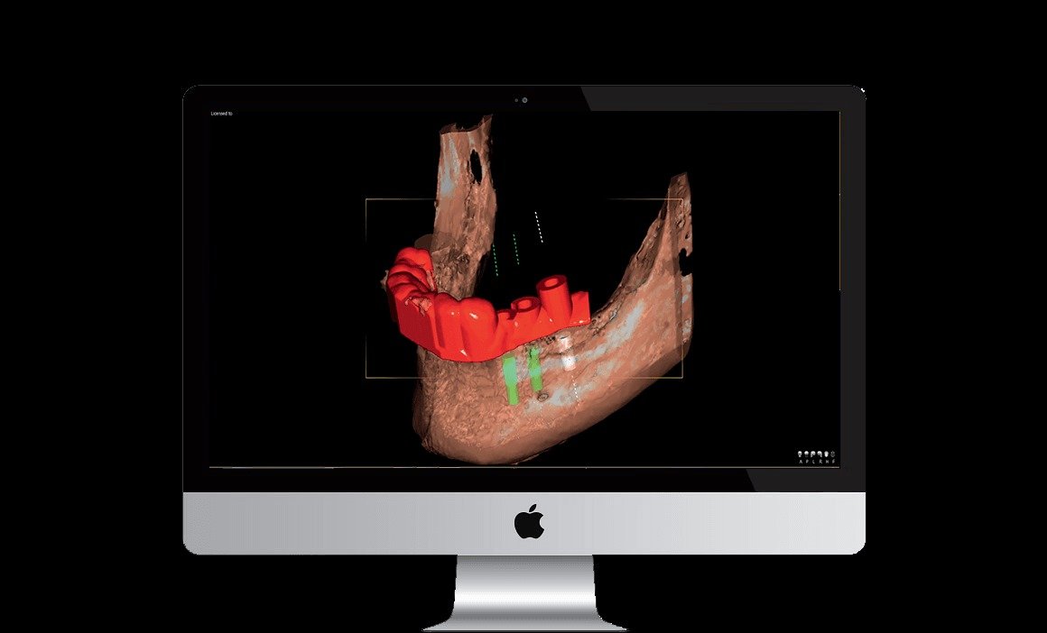 Owandy I-MAX PRO 3D CBCT (ثلاثية الابعاد) - Image 5
