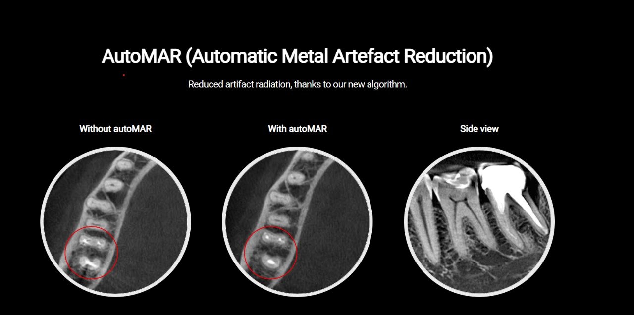 Owandy I-MAX PRO 3D CBCT (ثلاثية الابعاد) - Image 6