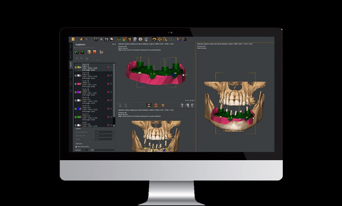 Owandy I-MAX PRO 3D CBCT (ثلاثية الابعاد) - Image 7