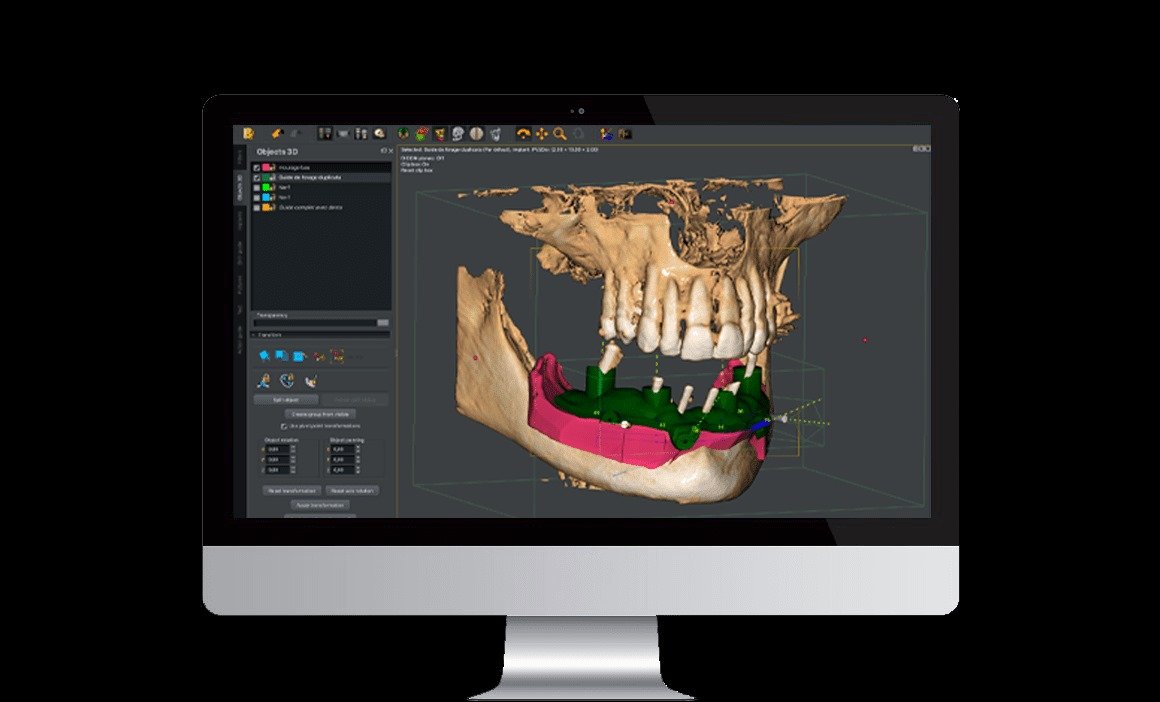 Owandy I-MAX PRO 3D CBCT (ثلاثية الابعاد) - Image 8