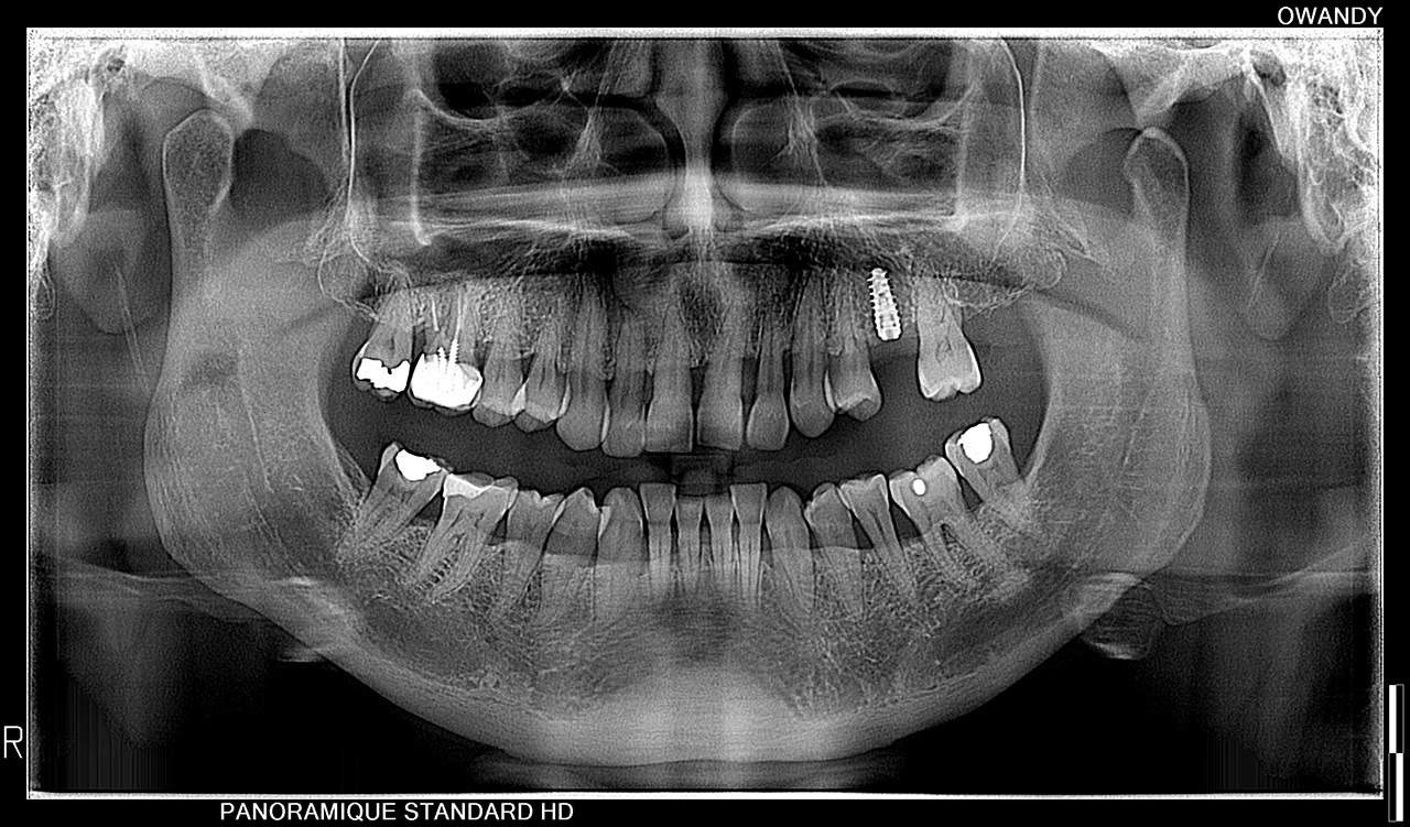 Owandy I-MAX PRO 3D CBCT (ثلاثية الابعاد) - Image 9