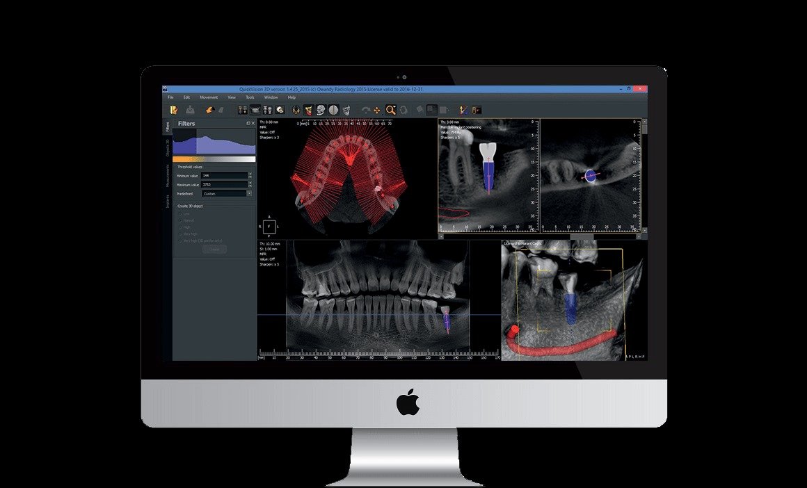 Owandy I-MAX PRO 3D CBCT (ثلاثية الابعاد) - Image 10