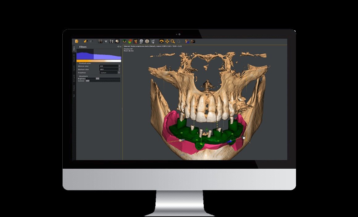 Owandy I-MAX PRO 3D CBCT (ثلاثية الابعاد) - Image 11