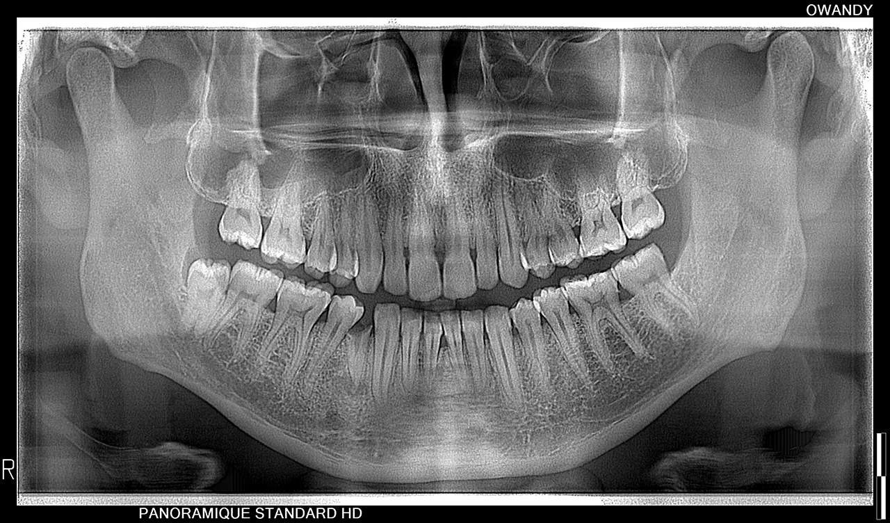 Owandy I-MAX PRO 3D CBCT (ثلاثية الابعاد) - Image 3